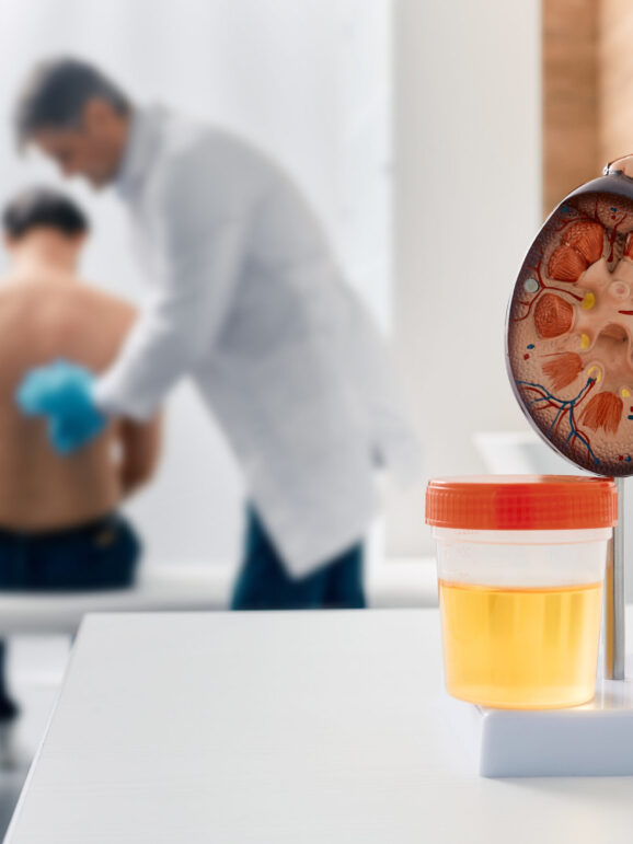 Urology and treatment of kidney disease. Doctor doing kidney exam for male patient with kidney disease, soft focus Urologie Untersuchung